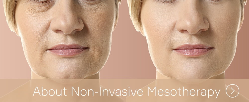 About non-invasive mesotherapy