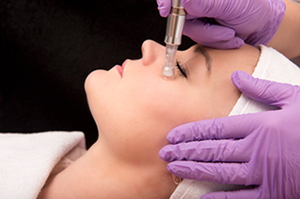 Mesotherapy for eyes